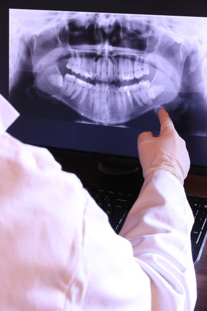 Best Cracked Tooth Emergency Dentist  in Town Line, NY